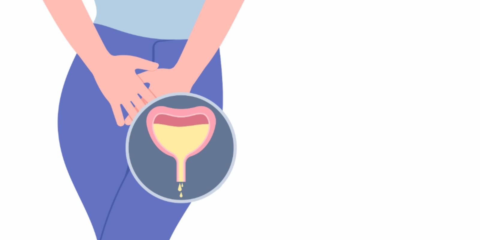 Urge vs. Stress Incontinence: What’s the Difference and How We Can Help?